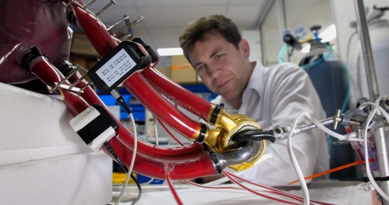 El corazón artificial de BiVACOR ofrece una nueva esperanza para los pacientes que esperan un trasplante de corazón. (Foto: Divulgación / BiVACOR)