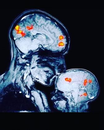 La fluctuación hormonal masculina está relacionada con la reducción del volumen cerebral. (Imagen: Instagram)