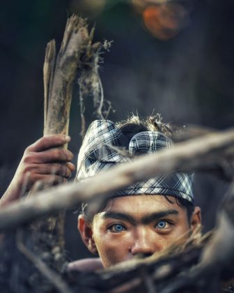 Esta peculiaridad se debe a una condición genética conocida como Síndrome de Waardenburg (Imagen: Instagram / korchnoi pasaribu)